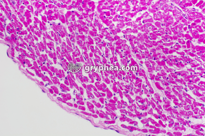 Fibres musculaires cardiaques CT x100 - gryphea.com